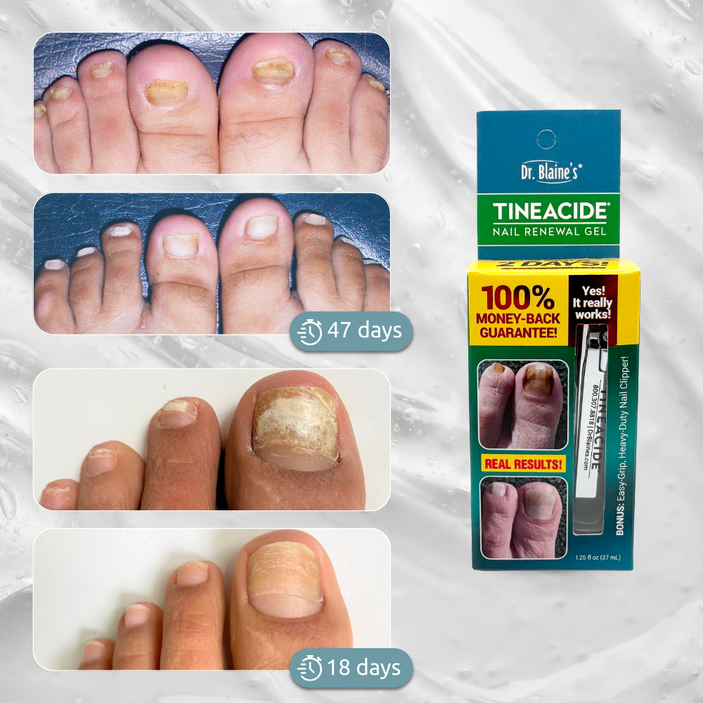 Dr Blaine's Tineacide Nail Renewal Gel 1.25oz - 12Pack