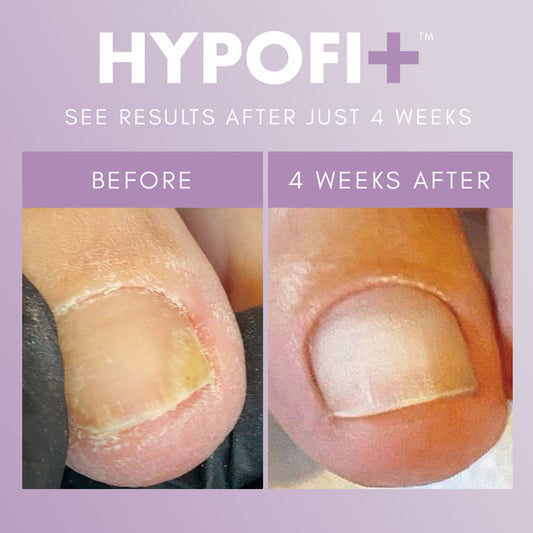 TGB HypoFix Primer .68oz